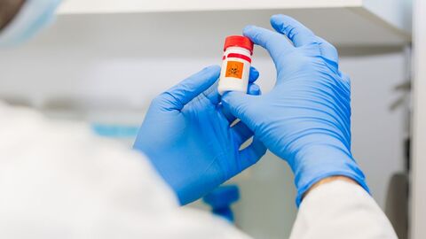 gefährliche Arbeitsstoffe müssen hinreichend gekennzeichnet sein Hände in blauen Einweghandschuhen halten einen kleinen Behälter mit Gefahrensymbol Totenkopf